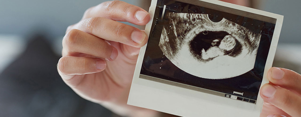 NIPT: o exame de pré-natal que avalia o DNA do bebê a partir do Sangue Materno.